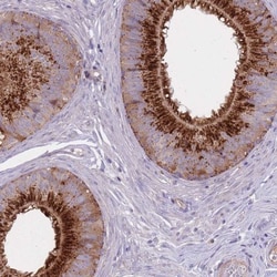 C2orf55 Antibody, Novus Biologicals:Antibodies:Primary Antibodies